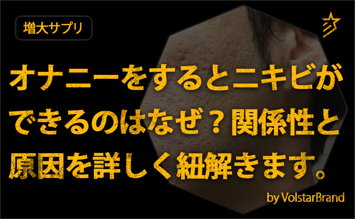 ボクサーパンツデビューしたんですけど、アソコの向きは普通、上 - Yahoo!知恵袋