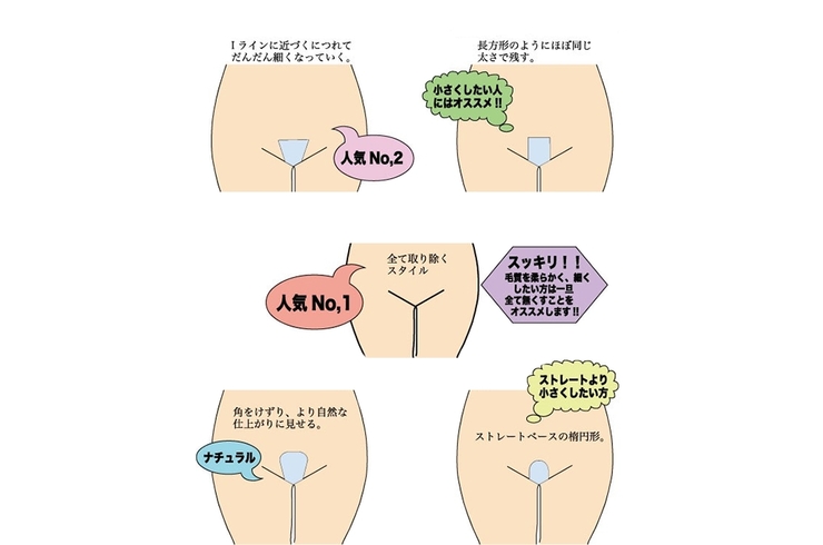 札幌でVIO医療脱毛が安いおすすめクリニック13選！都度払い対応院や口コミも紹介 | ExecuIT