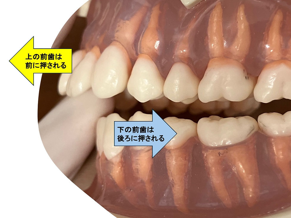 指しゃぶり 防止 手袋 てぶくろ