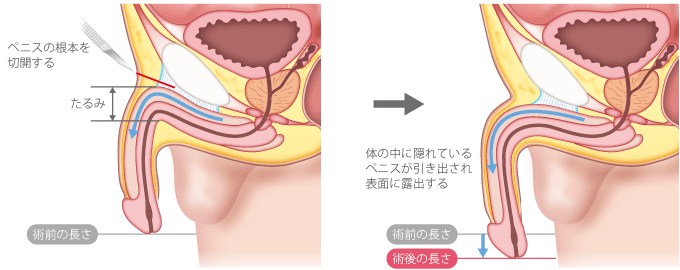 平均ペニスサイズアンケート集計！女性の理想や大きさより大事なこと | 【きもイク】気持ちよくイクカラダ