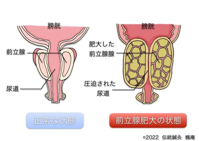 男性不妊をもたらす、４つの原因 精子はこうして作られる | みんな不妊に悩んでる