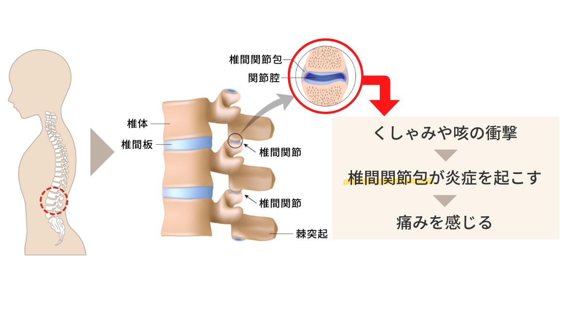 ぎっくり腰が一日で治った？歩けるけど痛いときの知恵袋 - 整体の操和｜沖縄県浦添市の痛みと痺れの整体院