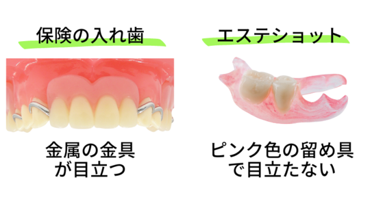 エステ・ネイル・アイラッシュ用チェア・ベッド | タカラベルモント