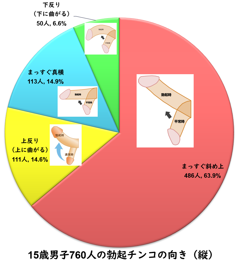 勃起した時に上向きに勃ちません。 | セイシル