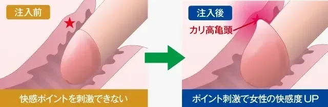 ペニスの構造や勃起の仕組みは？平均サイズ【医師監修】 - 夜の保健室