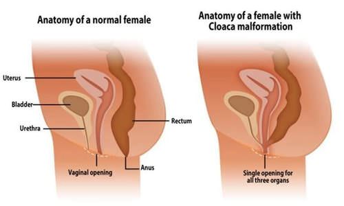 アナル中出しエロ画像】アナルセックスは危険日気にせず中出しできる！？（16枚） | エロ画像ギャラリーエロ画像ギャラリー