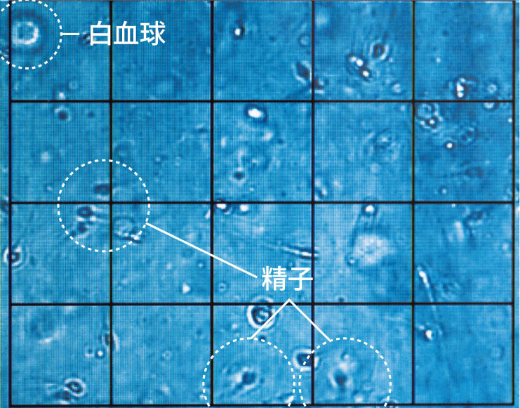 頑張れ精子くん ｜ 神奈川県横浜市の漢方薬局 回徳堂薬局