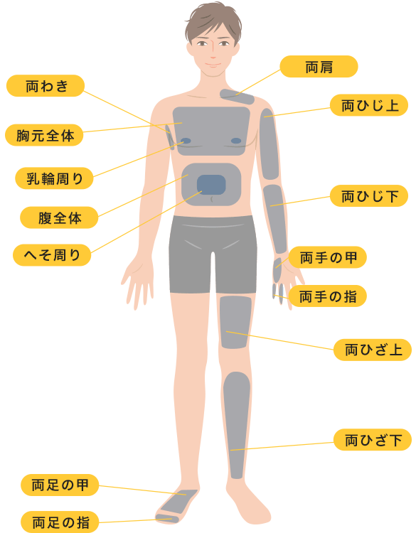 メンズVIO脱毛 医療脱毛はたつどころではない！！！