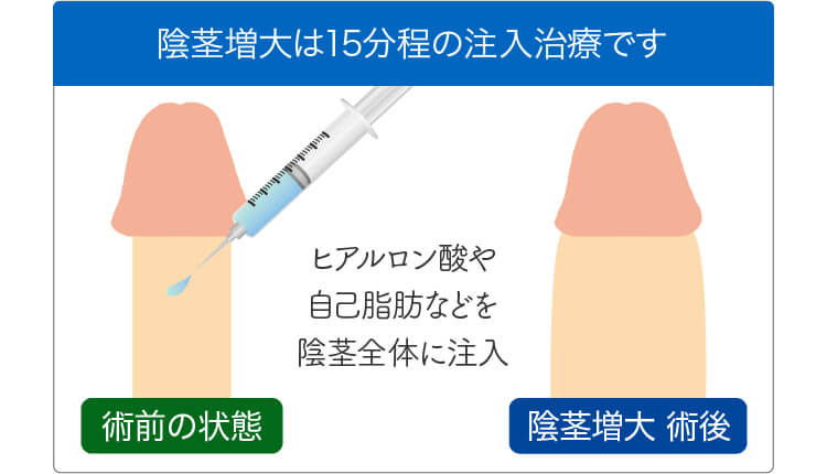 オナニー頻度とペニスサイズの関係 - 性についてのアンケート調査