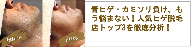 メンズ全身脱毛の値段を脱毛方法別に徹底比較！予算内で理想の肌を手に入れよう | メンズ脱毛百科事典 リンクスペディア