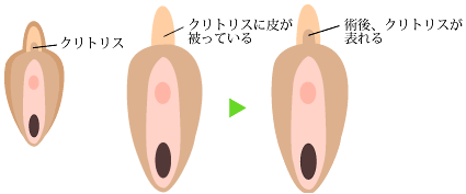 クリトリス勃起とは？勃つ理由とやり方 - 夜の保健室