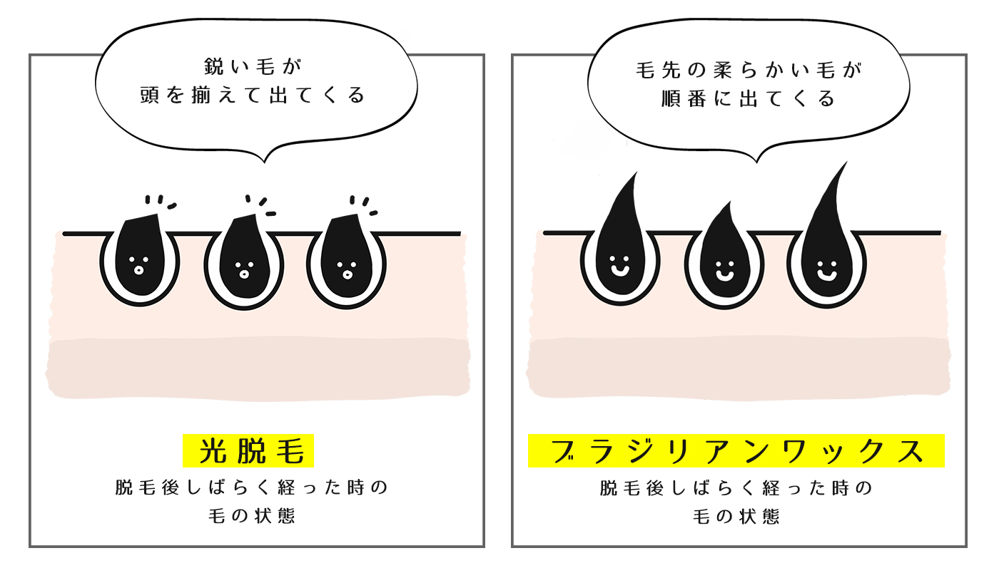 定期的な脱毛効果 | ブラジリアンワックス沖縄 脱毛&薄毛ケア｜格安 都度払いで安心の人気店