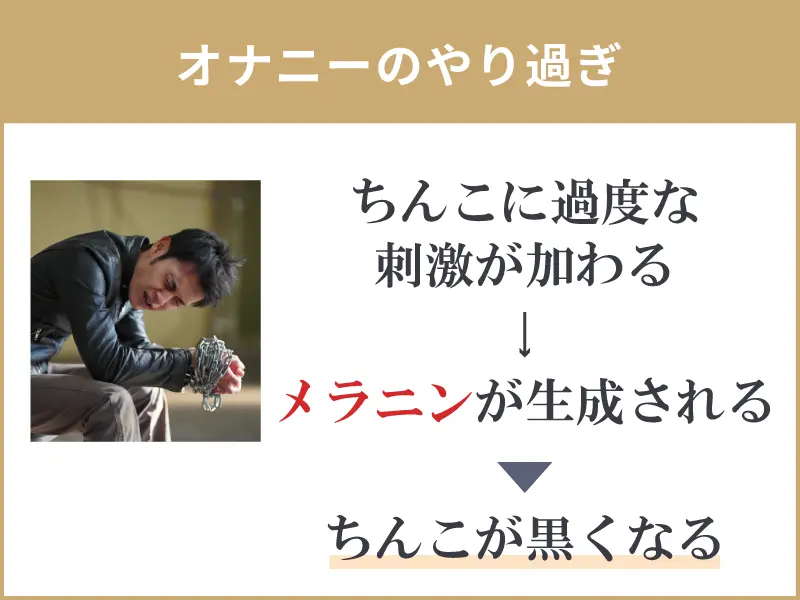 ペニスや陰嚢など、男性器の色が年々黒くなっていくのが気になります…【専門医が回答！男性の体Q&A⑨】 | yoi（ヨイ）