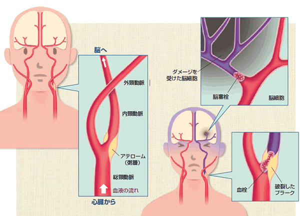 首絞めセックス〜〇〇な身体に教え込み〜(耳元はぁれむ) - FANZA同人