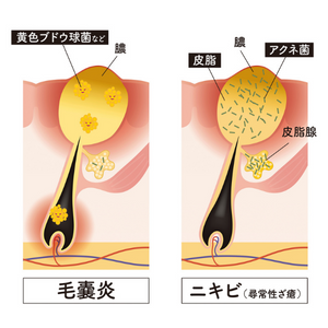 女装のプロは本番の数日前からヒゲを伸ばす - 羽鳥商店