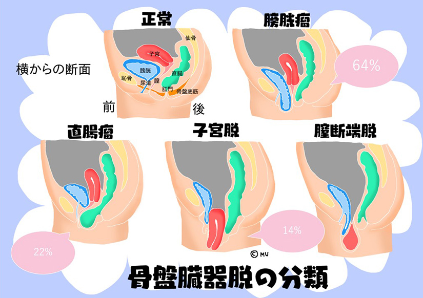 膀胱炎 | ジャスミンレディースクリニック渋谷・新宿・池袋・東京・大宮