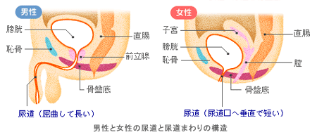 腹圧性尿失禁｜神戸市東灘区 摂津本山｜いしむら腎泌尿器科クリニック