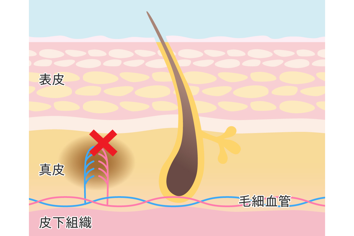 キスマークをつける男女の心理的な理由とは？つける場所で異なる意味を解説！ | Smartlog