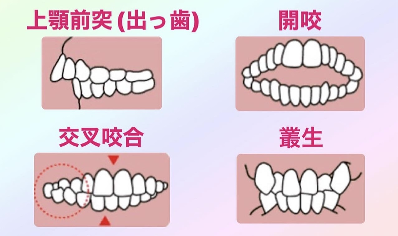 指しゃぶりはいつまでにやめさせるべき？やめさせ方や注意点を紹介 | 学習プリント.com 子育て情報サイト