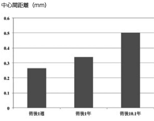 楽天市場】[ 公式 / 大山式 ボディメイクリング