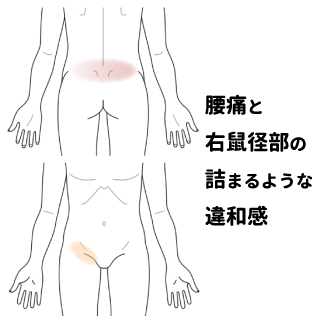 鼠径部（鼠蹊部）とは？図のどこですか？鼠径部で疑われる病気は？