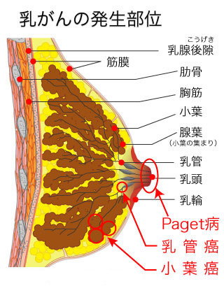 乳輪にあるぶつぶつの正体は？目立ってしまう原因や改善方法を解説｜共立美容外科