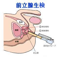 電磁ピストン×振動 前立腺マッサージ 割引 2点同時責め