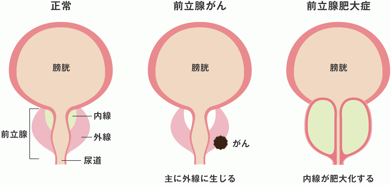 りのあ 天使👼と悪魔😈２つの顔を持つ痴女 on X: 