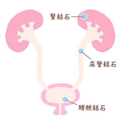 女性泌尿器｜自由が丘ウロケアクリニック｜女性医師が診る、目黒区自由が丘駅の女性泌尿器科・小児泌尿器科