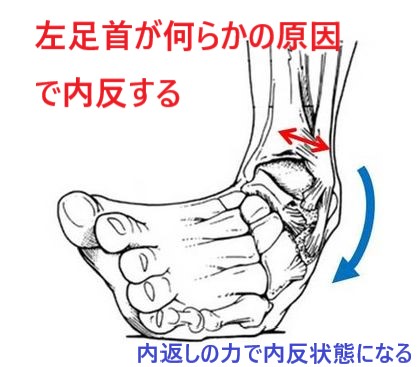 腰を鳴らさないと痛い場合は○○が原因です！ 流山NO１整骨院スタッフが解説 - あさば整骨院グループ