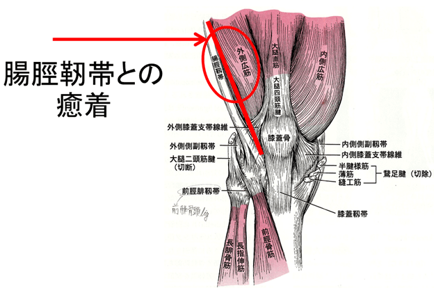 鼠径ヘルニアの治療｜外科・消化器外科｜診療科・部門｜湘南慶育病院