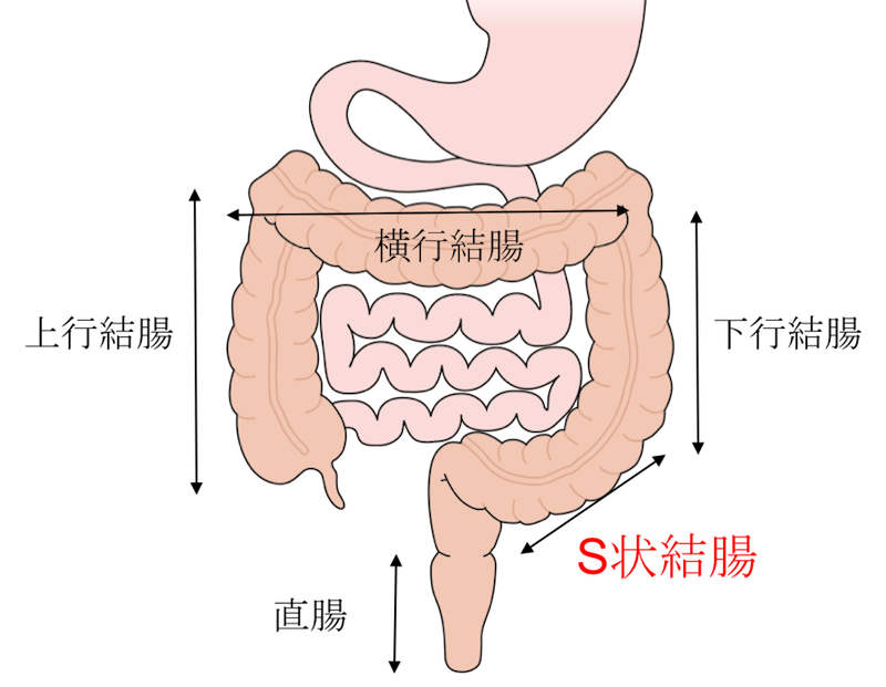 特集 大腸がんは 「患者力」を 必要としている