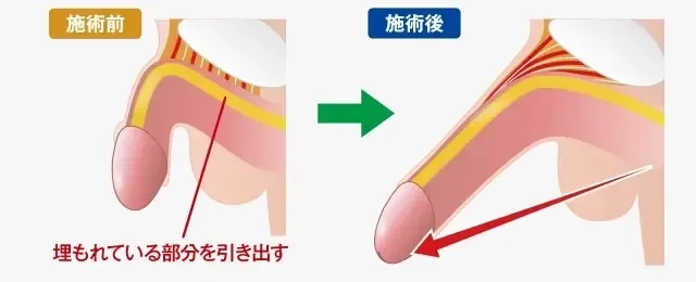 気持ち良くない!?短小男性器に対する女性のホンネ - YouTube