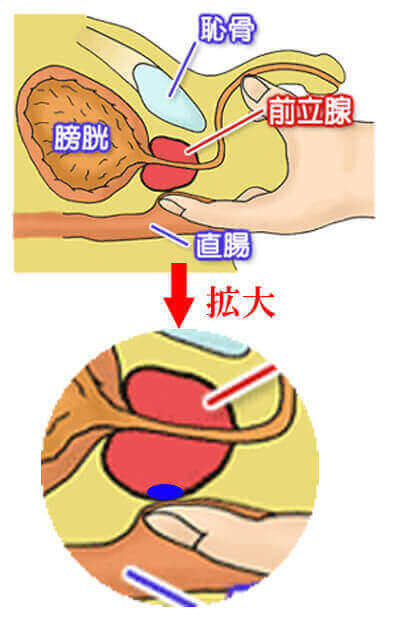 アナルオナニーをするなら前立腺・膀胱・精嚢の位置をイメージせよ | アネドラ