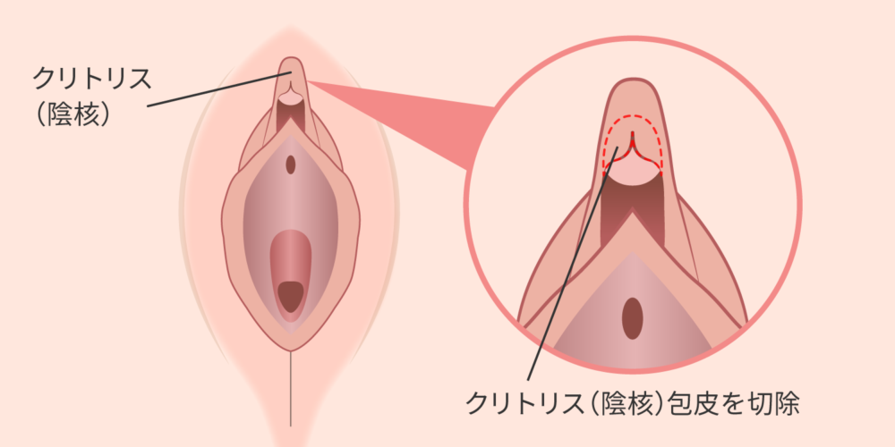 クリトリスの場所はどこ？構造・役割と快感を感じるためのいじり方 | Ray(レイ)