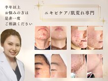 蘇我 リラクゼーションエステ「健康苑」