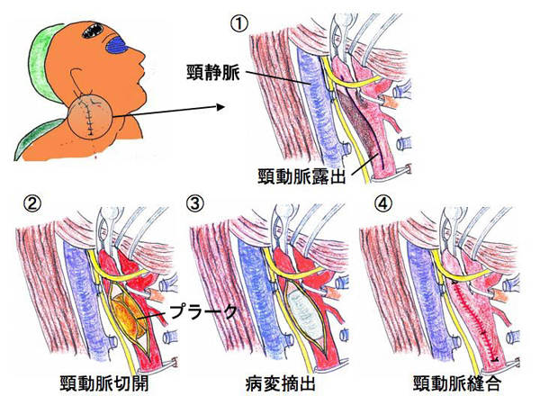 生化 - Denticola｜歯科医師国家試験のポイント