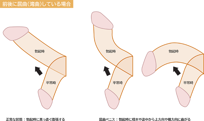 あの『ペニスの形』には意味があるの？ちんこの亀頭があの形の理由【ラブコスメ】