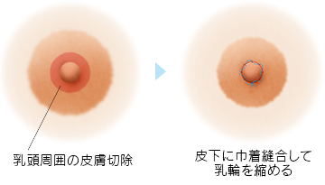 妊娠したらおっぱいはどう変わる？乳首のお手入れ方法は？-おむつのムーニー 公式 ユニ・チャーム