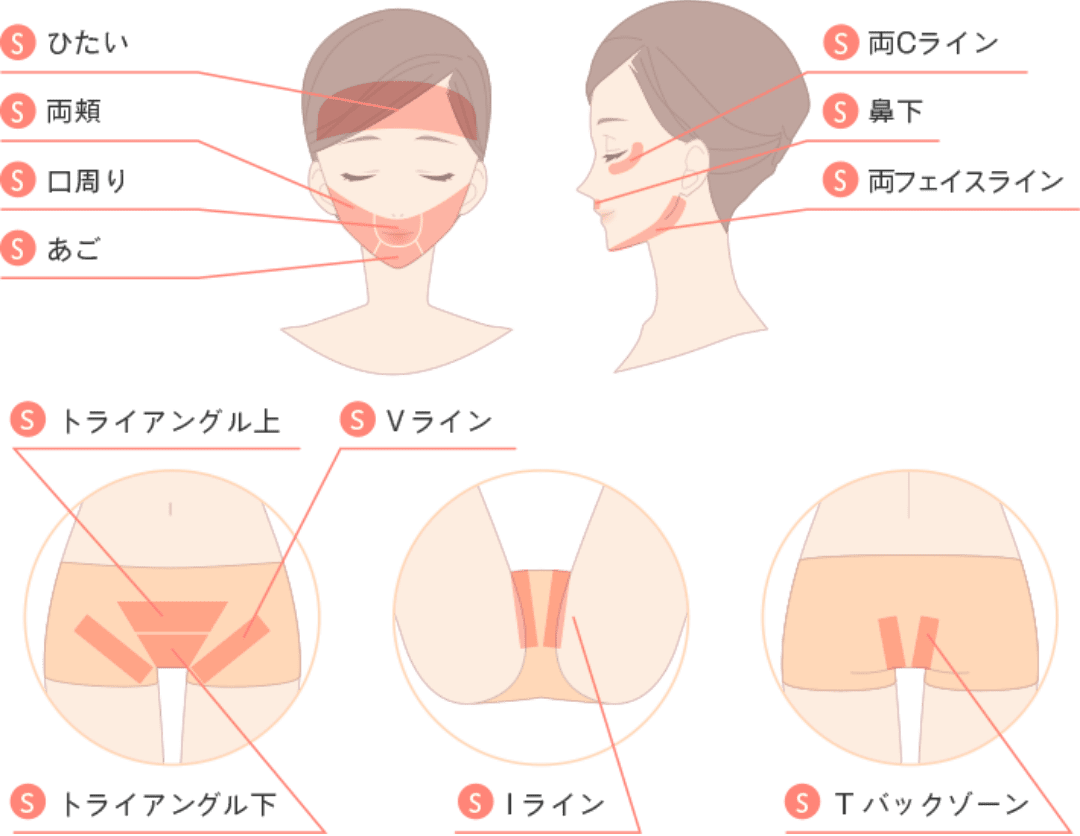 脱毛するならジェイエステティック！全国に88店舗。アクセス方法や営業時間について徹底解説！ - 名医のチョイス