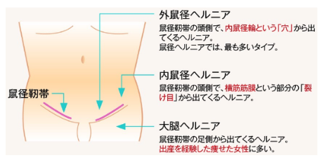 2024年】関東エリアの鼠径ヘルニア治療 おすすめしたい6医院 | メディカルドック