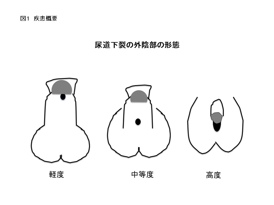 【男性必見】女性の膣を広げる方法【性のお悩み相談vol.22】