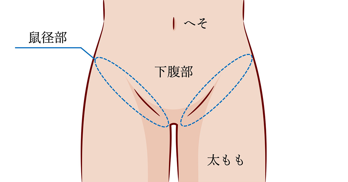 鼠径 部 リンパ マッサージ :