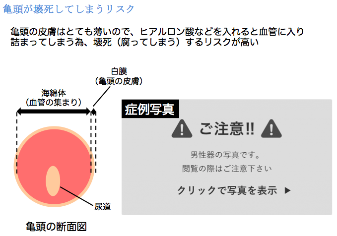 デリケートゾーン(陰部)のできもの｜ニキビ・しこり・イボなどの原因を解説｜wakanote