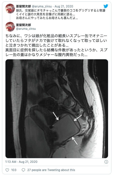 お手軽】気持ち良さ別ディルドの代わりになる代用品27選 | STERON