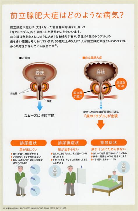 前立腺マッサージのコツは脱力にあり | アネロスジャパン | ANEROS