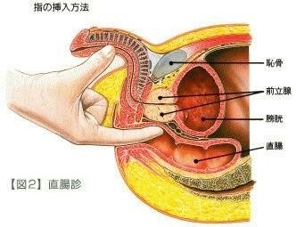 前立腺マッサージとはどんなプレイ？ 風俗エステ嬢がやり方を詳細解説 |