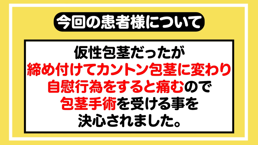 高校生 仮性包茎 オナニー