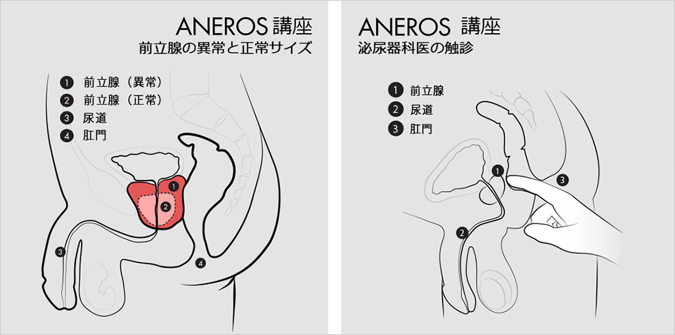 アナニーのコツがわかりません。 潮噴いたりメスイキするにはどうすればいいでしょうか？ |