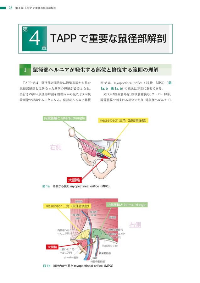 足の付け根がふくらむ「脱腸」